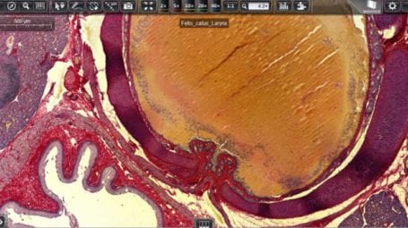 CaseViewer digital microscopy application