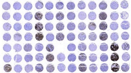 Tissue microarray (TMA) technique Reagent saving solution