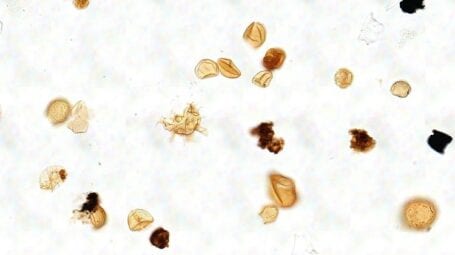 palynology slide in petroleum exploration