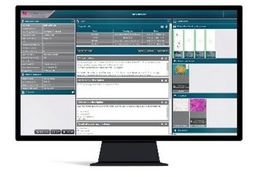 CaseManager Pathology Information System